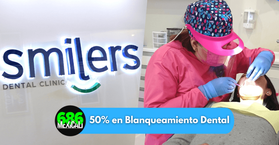 blanqueamiento dental mexicali 2