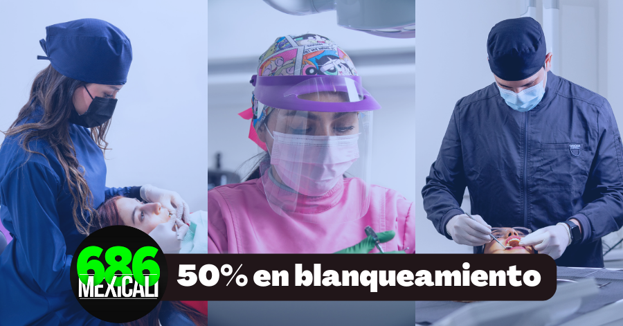 blanqueamiento dental 50%